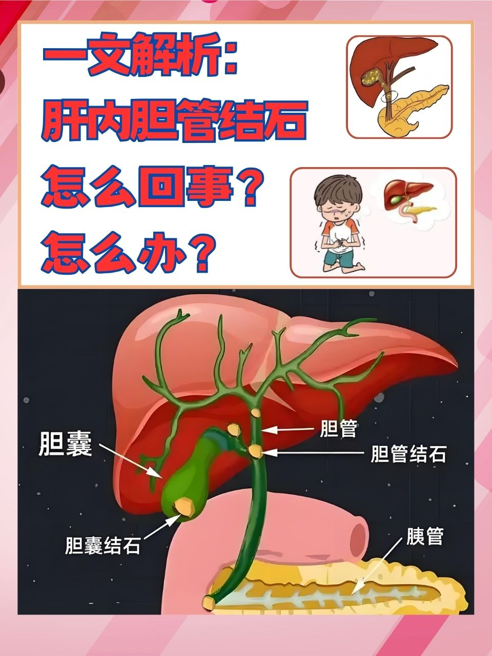 85a2cc6abe506db4ae363a6f8bdca0e8.png 85a2cc6abe506db4ae363a6f8bdca0e8.png