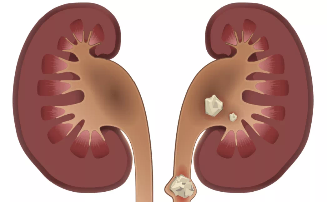 yYYBAGfiYQeAM76NAAQcGL1K9xk375.png yYYBAGfiYQeAM76NAAQcGL1K9xk375.png