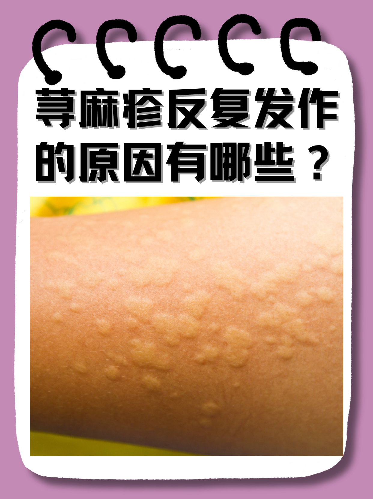 e3889c093953492b1c4d37226a7b805a.png e3889c093953492b1c4d37226a7b805a.png