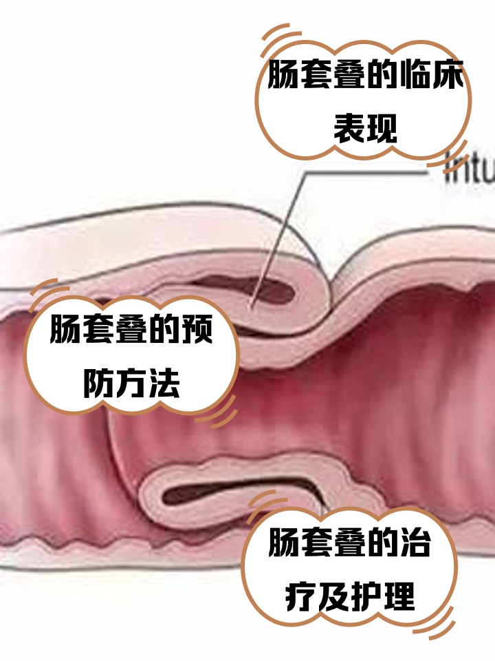 58ee3d6d55fbb2fbbd274b935d4a20a44623dc27.png 58ee3d6d55fbb2fbbd274b935d4a20a44623dc27.png