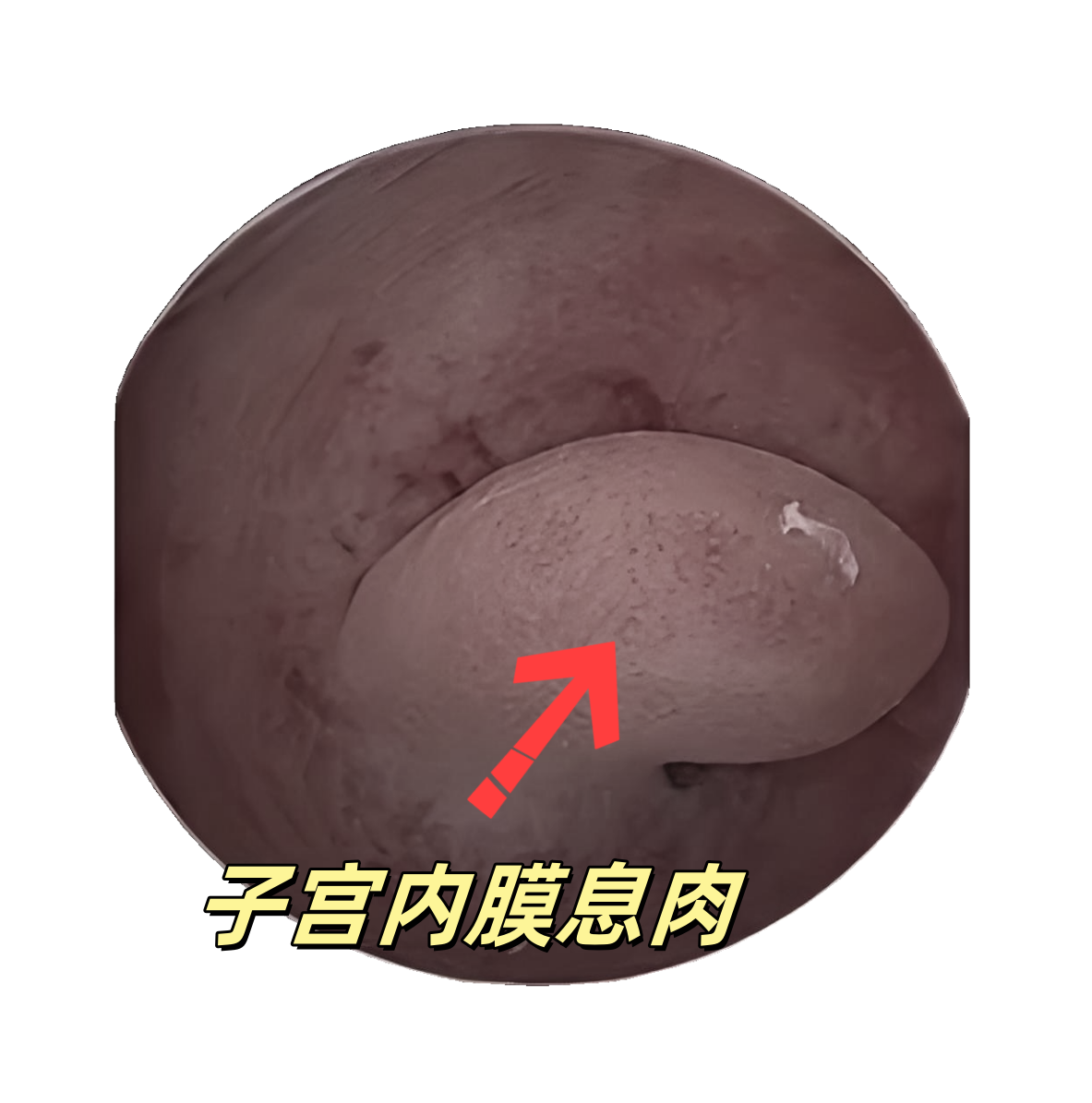 929e056d745f5bea9d0bf79a86816a75.png 929e056d745f5bea9d0bf79a86816a75.png