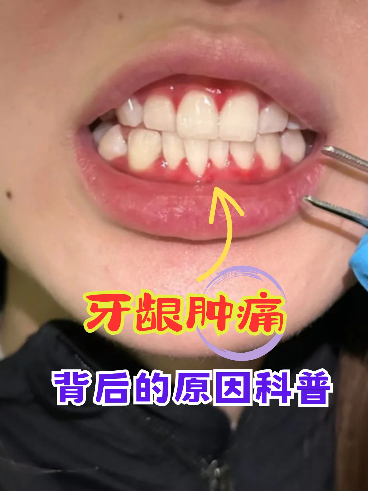 cc45e3f26cf9cc72d41eed2004d3c697.jpeg cc45e3f26cf9cc72d41eed2004d3c697.jpeg