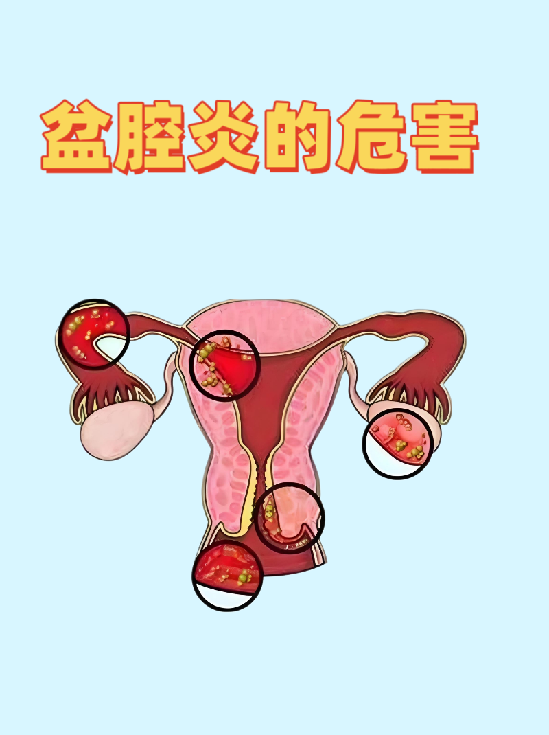 fewfew.png fewfew.png