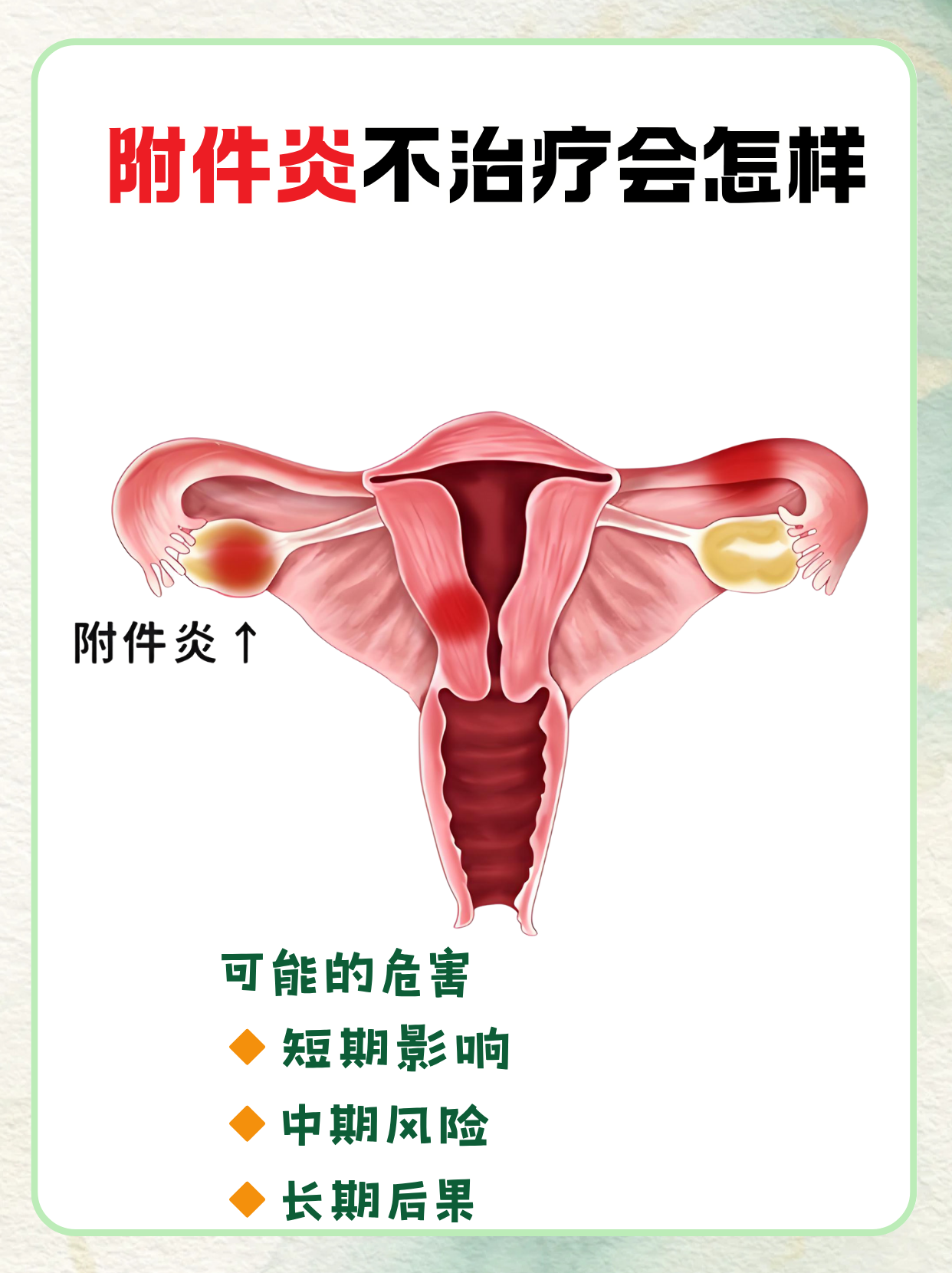 22137f25012122074ff3f30d1a9e50aa.png