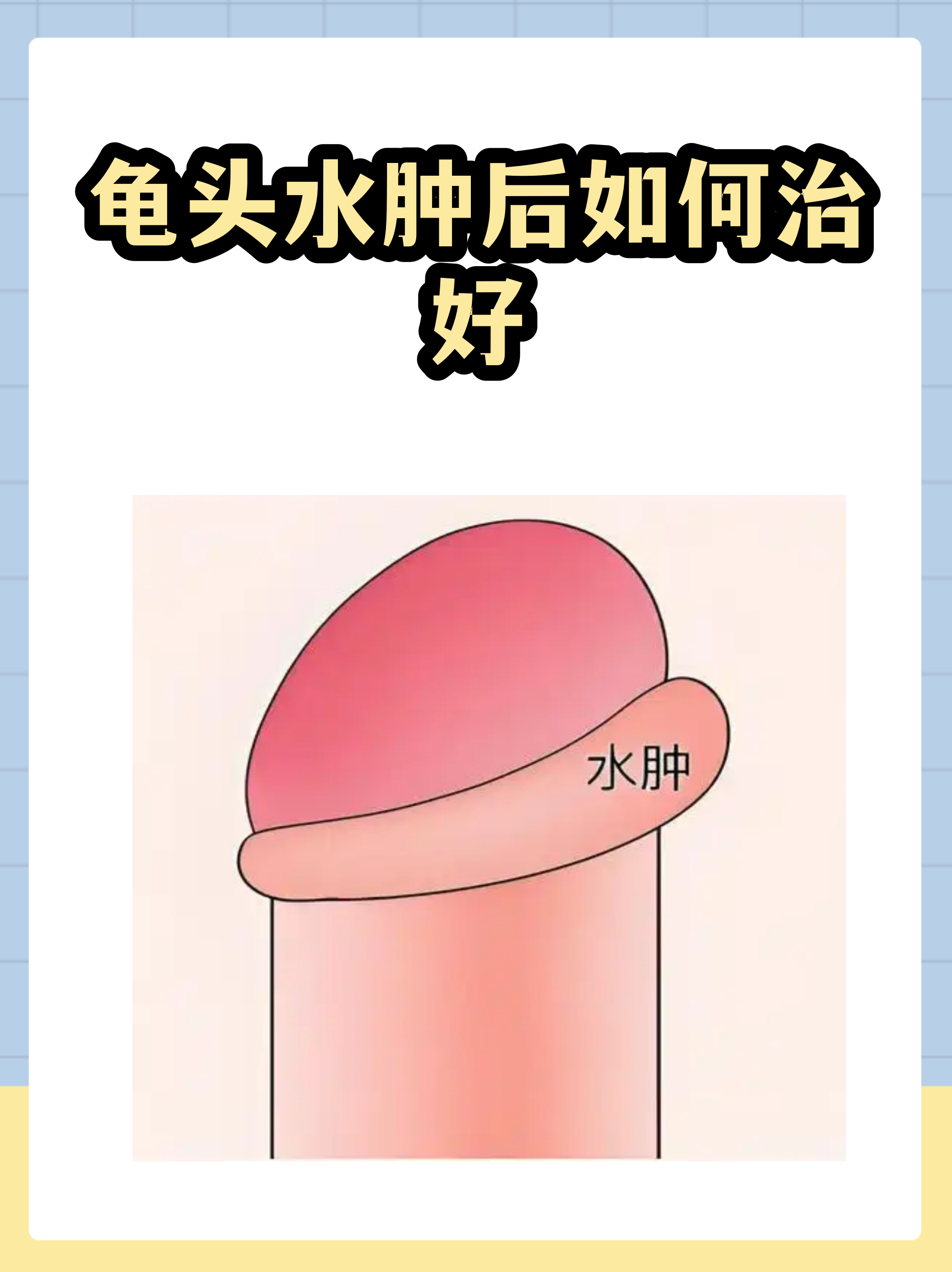 水肿.png 水肿.png