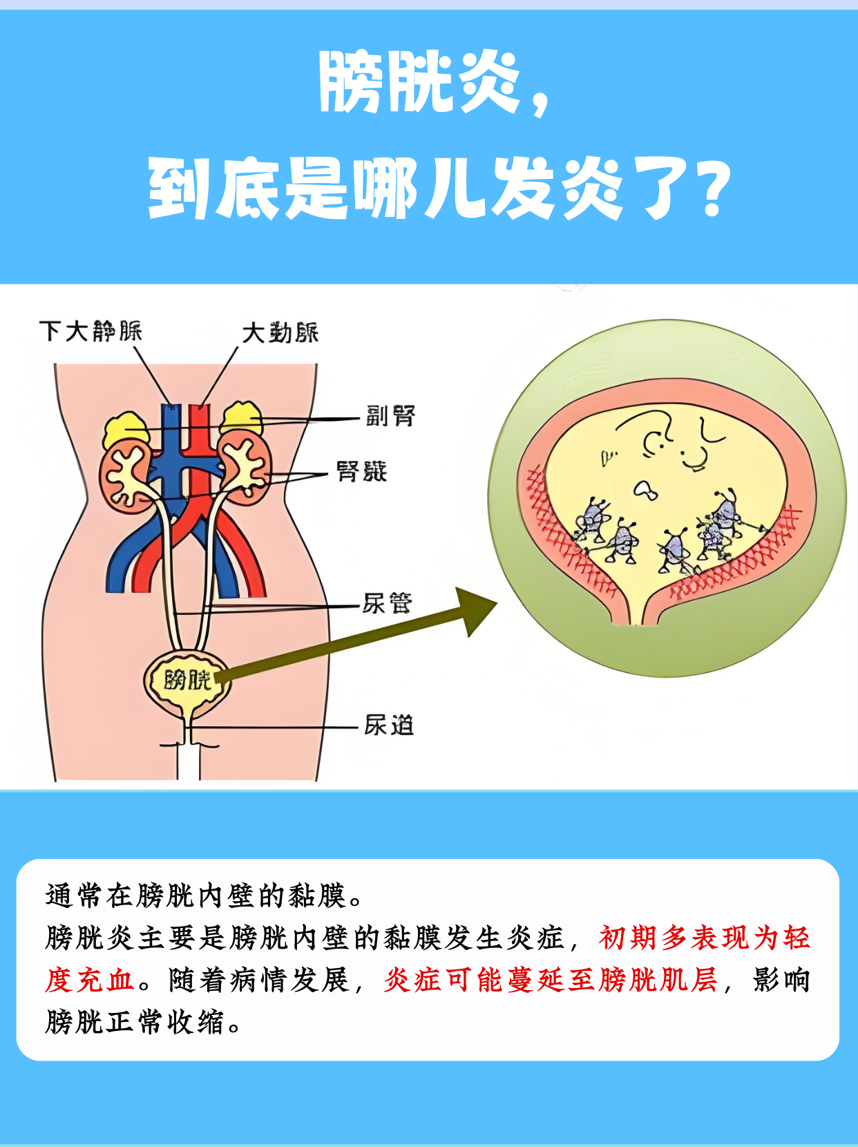 5b293ed7a666576d4244ae8e8b90a0ee.png