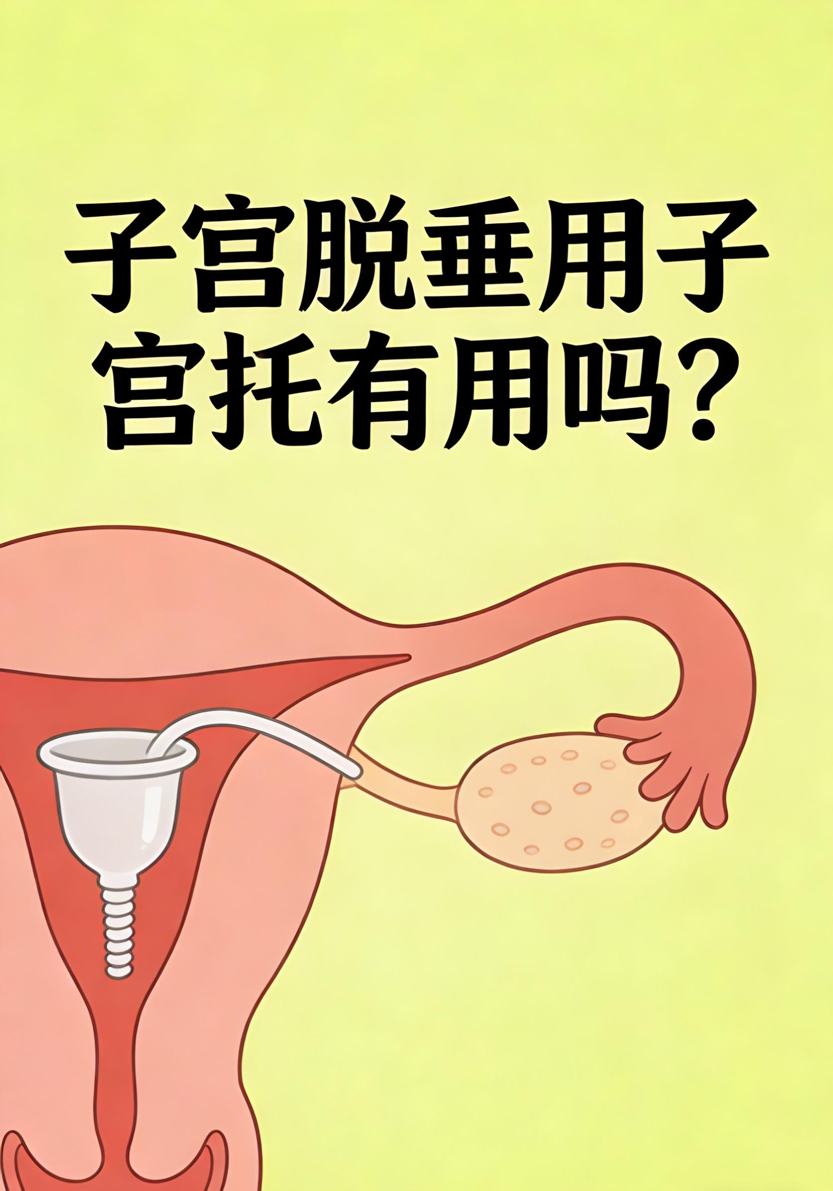 子宫脱垂.png