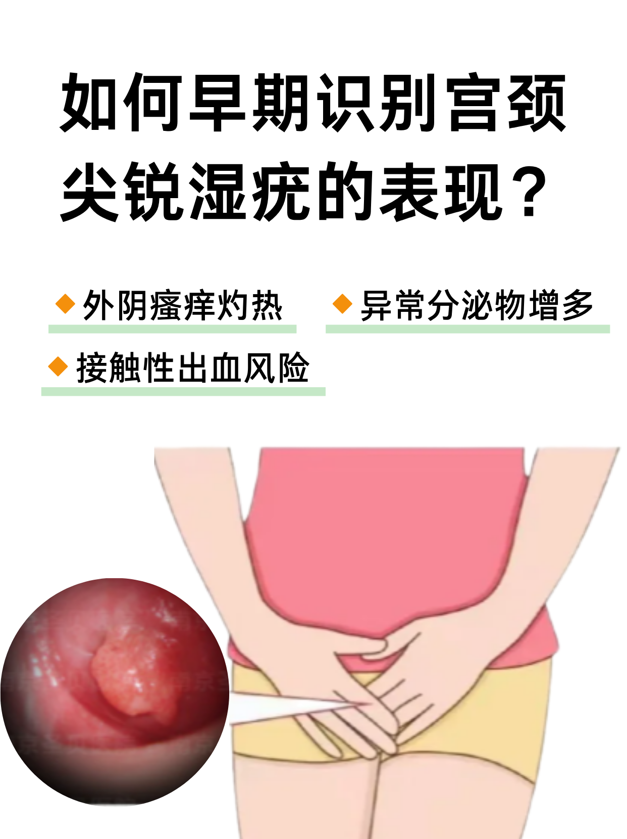宫颈.png 宫颈.png