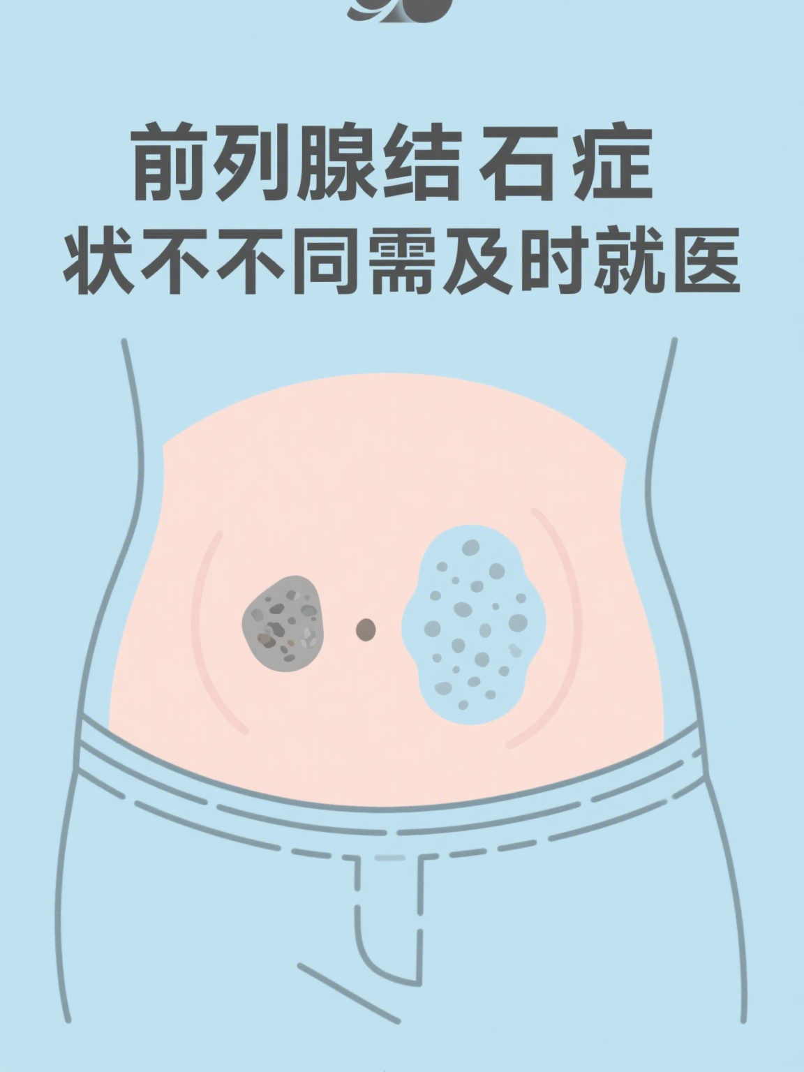 结石.png